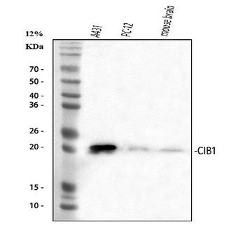 CIB1 Rabbit Polyclonal Antibody