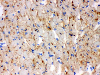 CPT1B Rabbit Polyclonal Antibody