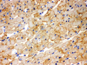CPT1B Rabbit Polyclonal Antibody