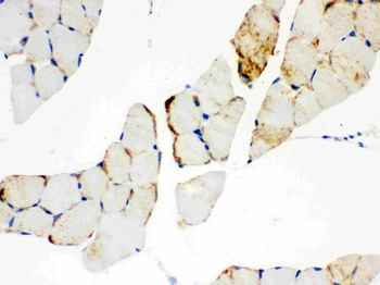 CPT1B Rabbit Polyclonal Antibody