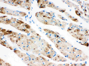 CPT1B Rabbit Polyclonal Antibody