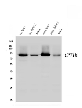 CPT1B Rabbit Polyclonal Antibody