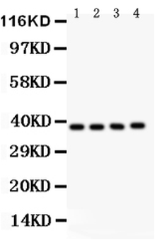 PINX1 Rabbit Polyclonal Antibody