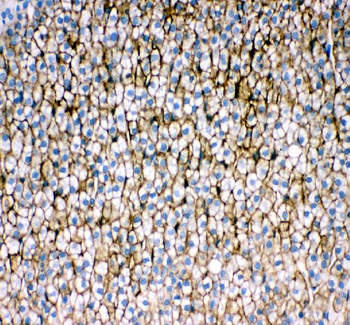 Scavenging Receptor SR-BI/SCARB1/SR Rabbit Polyclonal Antibody