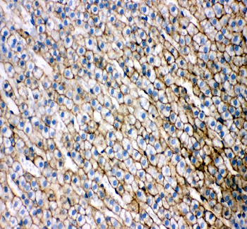 Scavenging Receptor SR-BI/SCARB1/SR Rabbit Polyclonal Antibody
