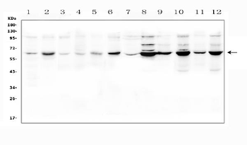 SLC19A1 Rabbit Polyclonal Antibody