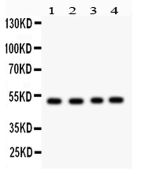 SOCS4 Rabbit Polyclonal Antibody
