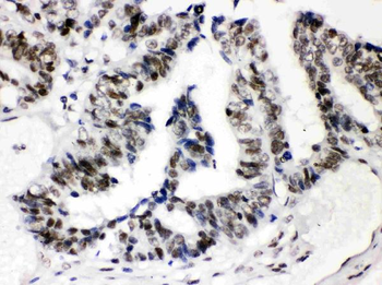 SP3 Rabbit Polyclonal Antibody
