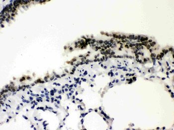 SP3 Rabbit Polyclonal Antibody