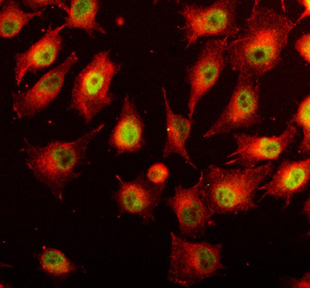 STAT3 Rabbit Polyclonal Antibody