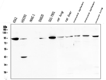 STAT5b Rabbit Polyclonal Antibody
