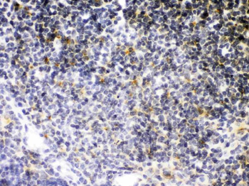 TNF Receptor II/TNFRSF1B Rabbit Polyclonal Antibody