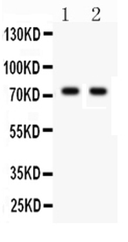 TNF Receptor II/TNFRSF1B Rabbit Polyclonal Antibody