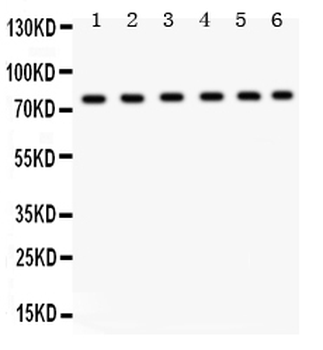 TRPV5 Rabbit Polyclonal Antibody