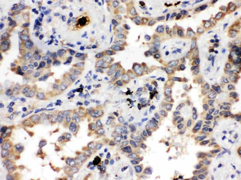 ULK3 Rabbit Polyclonal Antibody
