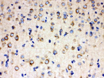 ULK3 Rabbit Polyclonal Antibody