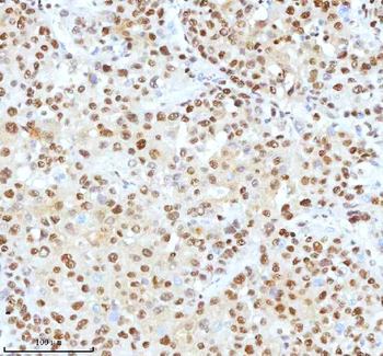 Ku70/XRCC6 Antibody