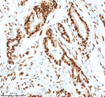 Ku70/XRCC6 Antibody