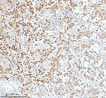 Ku70/XRCC6 Antibody