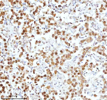 Ku70/XRCC6 Antibody