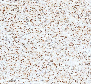 Ku70/XRCC6 Antibody