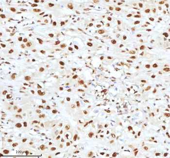 Ku70/XRCC6 Antibody