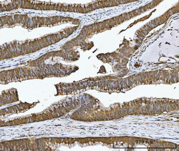 Carbonic Anhydrase I/CA1 Rabbit Polyclonal Antibody