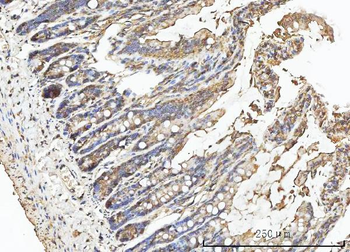 Carbonic Anhydrase I/CA1 Rabbit Polyclonal Antibody