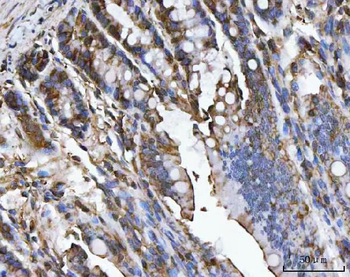 Carbonic Anhydrase I/CA1 Rabbit Polyclonal Antibody