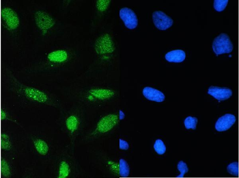 CDK1 Rabbit Polyclonal Antibody