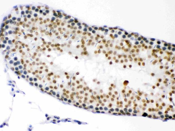 CDK1 Rabbit Polyclonal Antibody