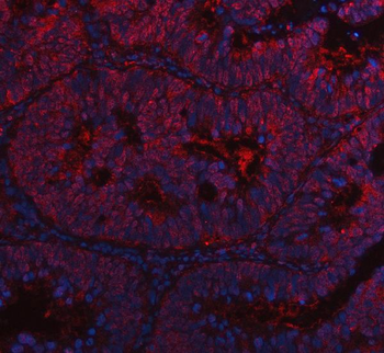 Cdk4 Rabbit Polyclonal Antibody
