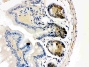 Cdk4 Rabbit Polyclonal Antibody