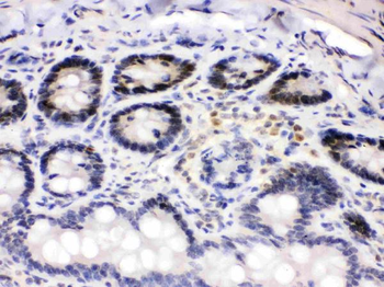 Cdk4 Rabbit Polyclonal Antibody