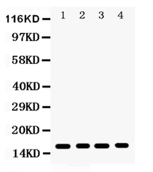 CENPA Rabbit Polyclonal Antibody