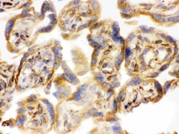 COMT Rabbit Polyclonal Antibody