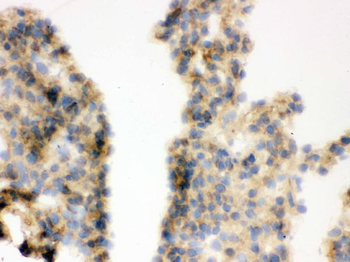 COMT Rabbit Polyclonal Antibody