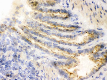 COMT Rabbit Polyclonal Antibody