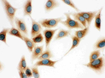 COMT Rabbit Polyclonal Antibody