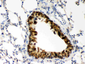 COMT Rabbit Polyclonal Antibody