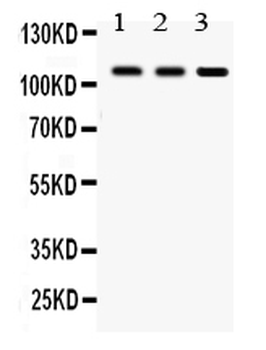 CYLD Rabbit Polyclonal Antibody