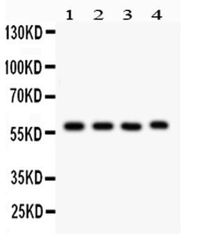 Cytochrome P450 1A1/CYP1A1 Rabbit Polyclonal Antibody