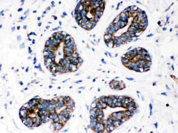 Cytochrome P450 1A1/CYP1A1 Rabbit Polyclonal Antibody