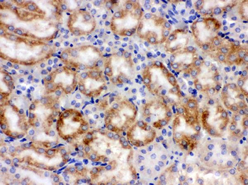 Cytochrome P450 1A1/CYP1A1 Rabbit Polyclonal Antibody