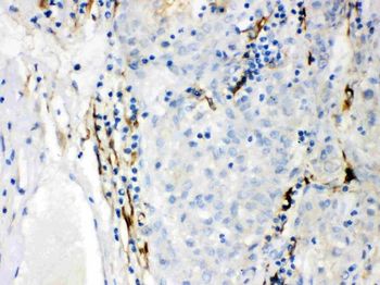 CYP1B1 Rabbit Polyclonal Antibody