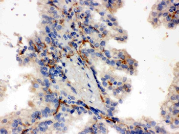 CYP27B1 Rabbit Polyclonal Antibody
