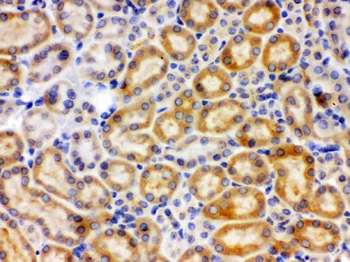 CYP27B1 Rabbit Polyclonal Antibody