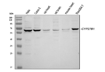 CYP27B1 Rabbit Polyclonal Antibody