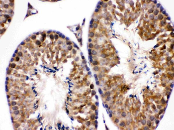 Endothelin B Receptor/EDNRB Antibody