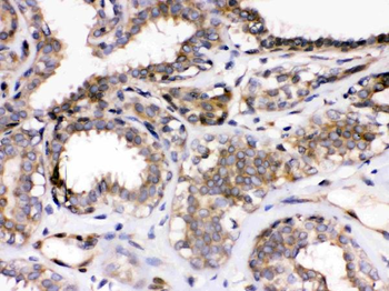 Parvin alpha/PARVA Rabbit Polyclonal Antibody